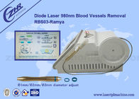 Rimozione delle vene varicose del laser a diodi del laser a diodi 980nm di rimozione dei vasi sanguigni