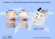 Macchina di pulizia portatile di 3in1 Diamond Dermabrasion Skin Peeling Facial
