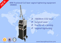 attrezzatura frazionaria del laser di CO2 40w/attrezzatura di rafforzamento vaginale commerciale