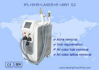 Macchina del laser IPL del ND YAG 530nm di rimozione dell'acne