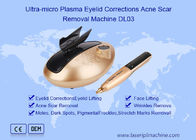 Macchina ultra micro di rimozione di Pen Eyelids Corrections Acne Scar del plasma
