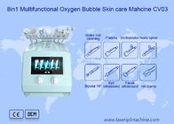 8 in 1 bolla multifunzionale dell'ossigeno della macchina 110v di bellezza di cura di pelle di Zohonice