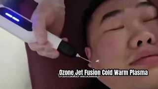 Ozone Jet Fusion Cold And Warm Plasma Machine per la rimozione delle rughe