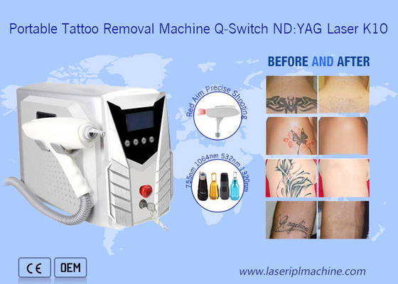 1064nm 532nm Laser Tattoo Removal Machine Portatile con maniglia staccabile