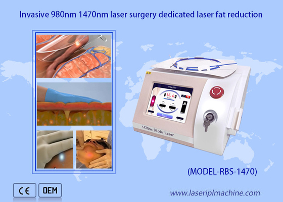 Laser ottico portatile della macchina 980nm 1470nm del laser a diodi di riduzione grassa del laser della fibra