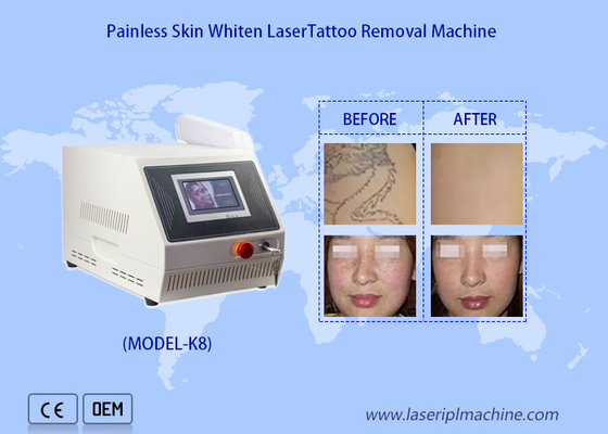 1320nm 1064nm 532nm Portatile Nd Yag Laser Tattoo Removal Machine sbiancante della pelle