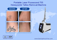 Dispositivo 755nm 1064nm 532nm della macchina di rimozione del tatuaggio del laser di picosecondo del ND Yag
