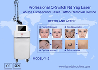 755nm macchina di rimozione del tatuaggio del laser di picosecondo del ND Yag