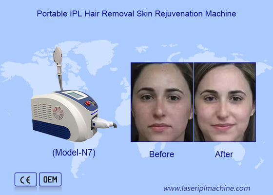 Eliminare i capelli con laser IPL avanzato e ringiovanire la pelle con il cristallo chiaro di zaffiro importato