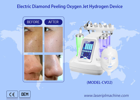 Pulizia profonda del viso Acqua Peeling a getto di ossigeno / idro Dermabrasione Acqua pulizia profonda della pelle a getto di ossigeno