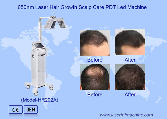 Macchina di stimolo della crescita dei capelli ad alta frequenza sicura