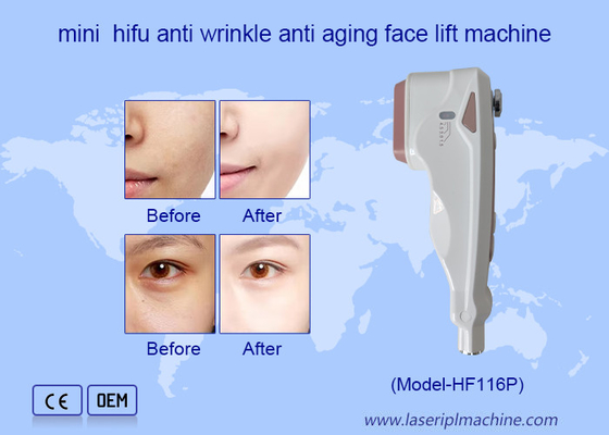 Uso domestico HIFU cura del viso rimozione delle rughe ringiovanimento della pelle face lifting machine