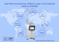 macchina frazionaria del laser di CO2 10600nm per rifare la superficie della pelle