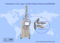 Macchina frazionaria del laser di CO2 di esame 10600nm 10x10mm di rimozione della cicatrice