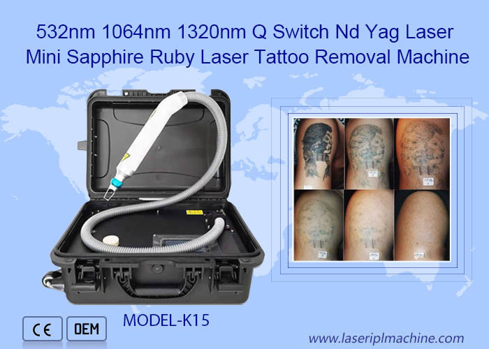 macchina per la rimozione del tatuaggio laser rubino zaffiro mini ND Yag del commutatore di 532nm 1064nm 1320nm Q