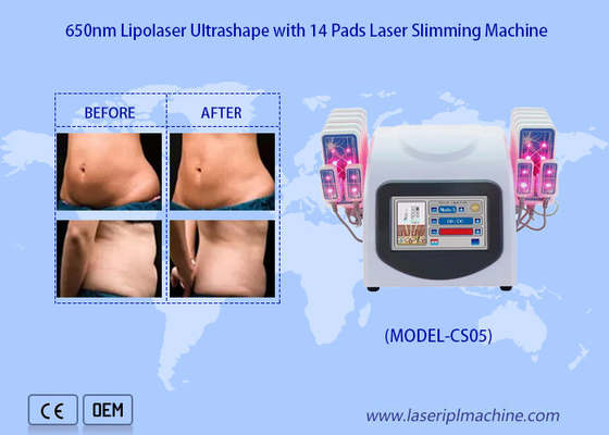 il laser di 650nm Lipo riempie la macchina della liposuzione del laser per riduce la rimozione grassa delle celluliti