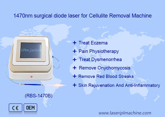 Buon prezzo 1470nm 980nm Diodo Laser Lipolisi Chirurgia Dispositivo laser Lipoidico in linea