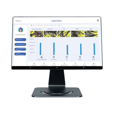 Buon prezzo Analizzatore del cuoio capelluto intelligente AI per 4 lingue, cura mirata del cuoio capelluto in linea